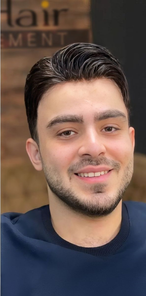 کاشت مو